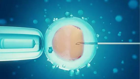 　　图片来源：视觉中国