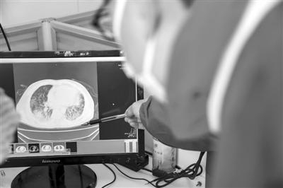 近日，在孝感市孝昌县第一人民医院，医生们正在分析患者医学影像。新华社 图