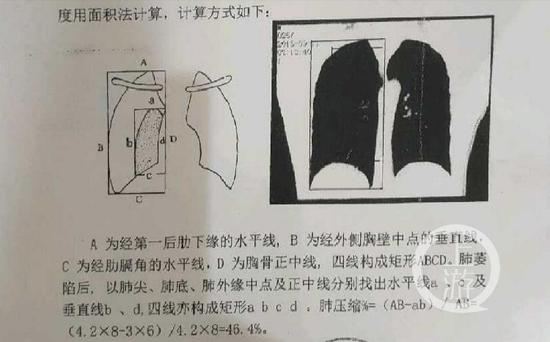 ▲2018年5月10日，法大法庭科学技术鉴定研究所对林某损伤鉴定为轻伤一级。受访者供图