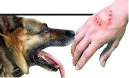 狂犬病有潜伏期，但并不是传说中的长达40年，这多是临床诊断，并非确诊病例。