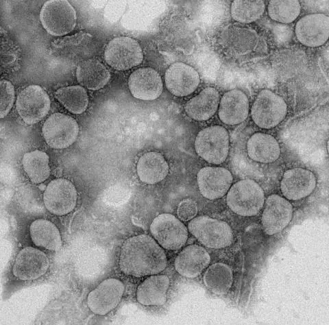 蝙蝠SARS样冠状病毒粒子 中科院武汉病毒研究所供图