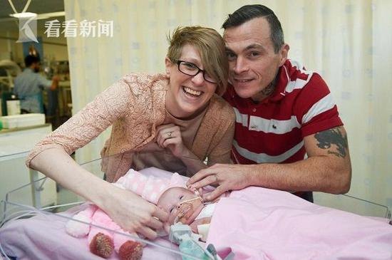 女婴心脏长在体外