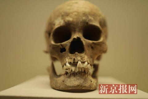 反映拔牙习俗的头骨。新京报记者 浦峰 摄