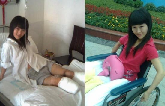 做完手术的廖智