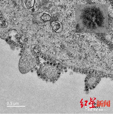 培养48小时后的冠状病毒电子显微镜图像