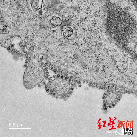 新型冠状病毒在细胞中生长的电子显微镜图像