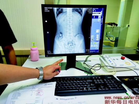 ▲X光机透视下的带毒人腹部。　　　　　南京铁路公安处供图