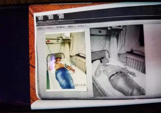 ▷ 证人王刚协助调查被询问时癫痫病发作住院