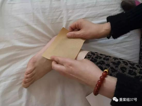 　　▲2019年1月21日，布病患者正在病房里给自己贴药膏，她得了布病关节炎，脚踝经常疼痛。新京报记者 吴靖 摄