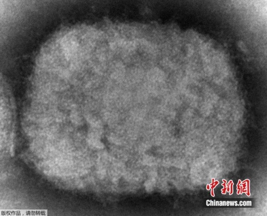 　资料图：美国疾病控制和预防中心（CDC）提供的2003年电子显微镜图像显示了一种猴痘病毒粒子。