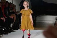 阳光小美女！英国7岁女孩双腿截肢当模特 走红网络