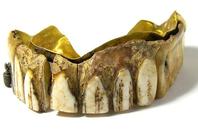 英国一男子发现两百年前黄金牙
