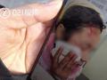 女子遭高空抛碗划破脸缝10针:从厨房扔出 里面还有吃剩的麦片