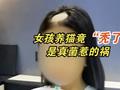 深圳一女孩养猫后“秃了” 医生:感染了猫身上的真菌