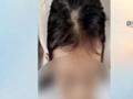 深圳一个月内5个娃头秃 医生:或与吸猫撸狗有关