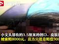弄假成真?女孩玩密室逃脱被道具刀砍伤头缝4针