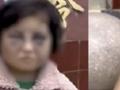 当地通报被打成“熊猫眼”女童安置情况:私自拿钱被其母打