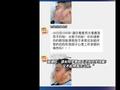 初中女生往男同学脸上泼开水致毁容,校方:给予女生警告处分