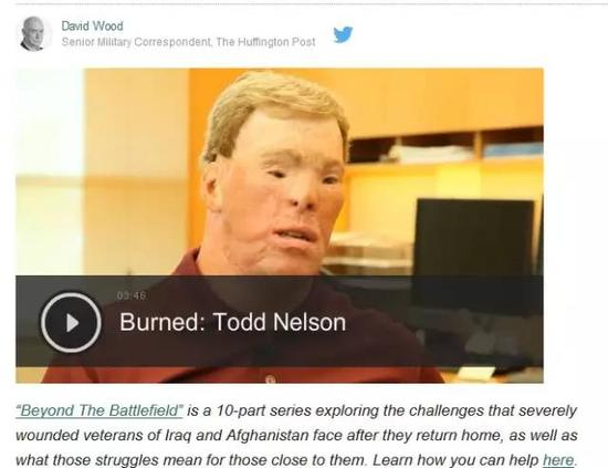 　　《赫芬顿邮报》记者大卫-伍德对在伊拉克战争和阿富汗战争中严重受伤的美国士兵在身体和情感上面临的挑战进行了深入的探究