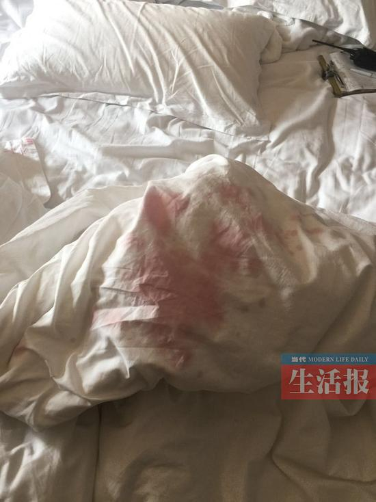  杜先生弄脏的被套。