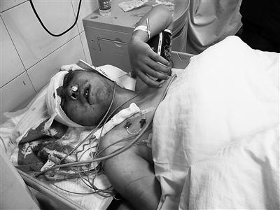 受伤环卫工正在治疗 西部商报记者金奉乾摄