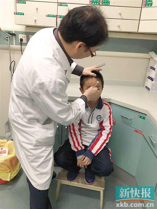 经医生检查，所幸伤口并不影响眼睛和视力。 受访者供图