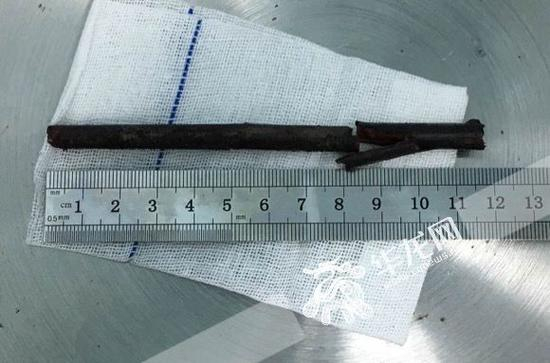  树枝足足有12厘米长。 院方供图 华龙网发