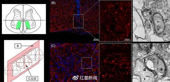 老鼠的神经系统示意图