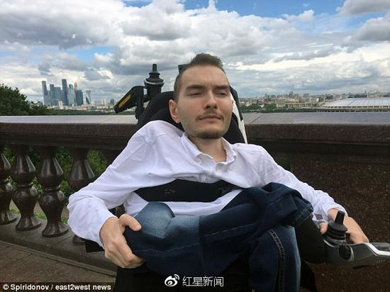 世界首位换头手术志愿者瓦列里·斯皮里多诺夫 图据east2west news