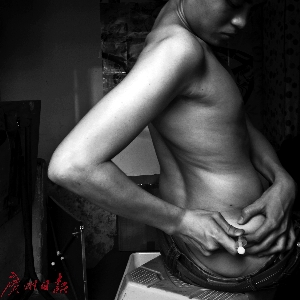 阿飞在给自己打性激素针