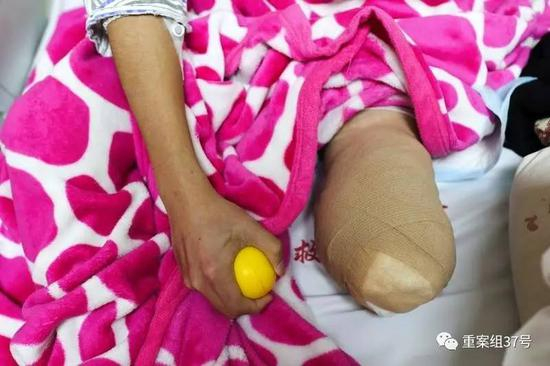 ▲尽管左小腿被截肢，但龚伟对大学生活仍充满憧憬。 &nbsp; &nbsp; &nbsp;新京报记者王飞 摄