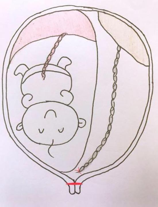 延迟分娩的过程。