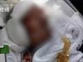 院方回应金龙泉创始人术后脑死亡:家属威胁至少赔偿2100万