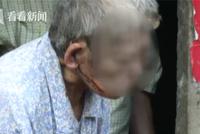 8旬老人遭孙子打伤血流不止未被送医:被怀疑偷钱