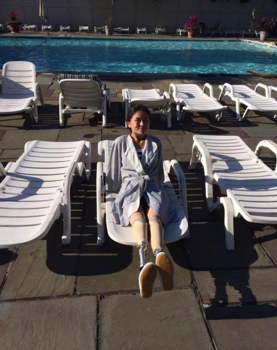 廖智晒“美腿”