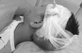 头被砍伤的9岁男孩小程。图/受访者提供