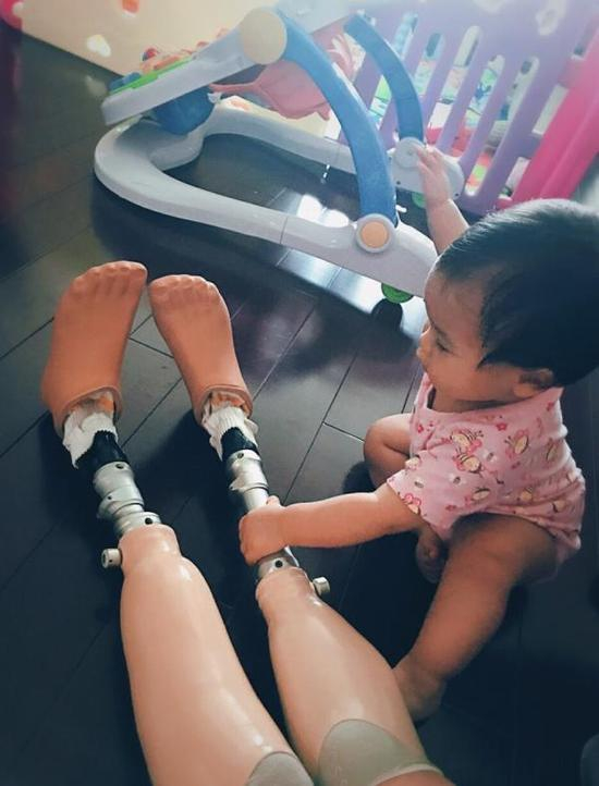 女儿在触摸妈妈“和她不一样”的腿