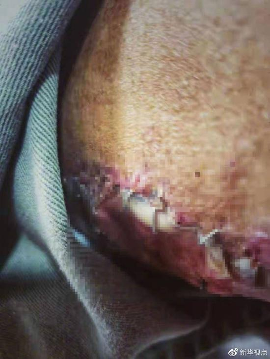 10月31日，多云。