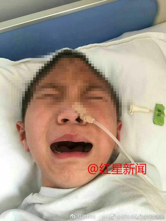 受伤接受治疗的鹏鹏