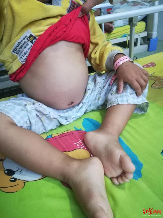 小俊熙的肚子鼓鼓的