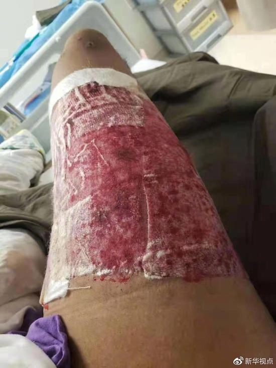 全身麻醉后，世界将变得安静。