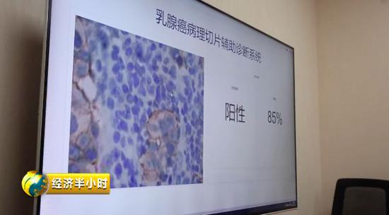 乳腺癌病理切片辅助诊断系统