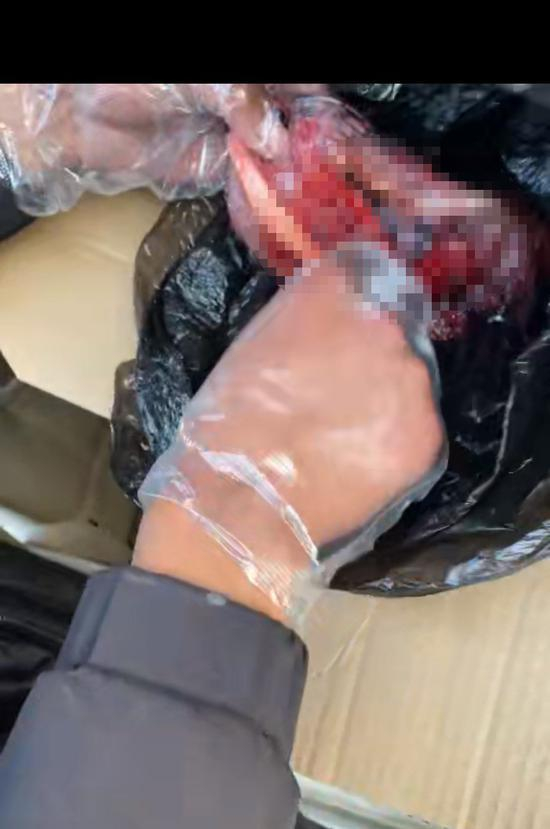 王余和记者接头验货，袋子中装满新鲜的人体胎盘。（视频截图）