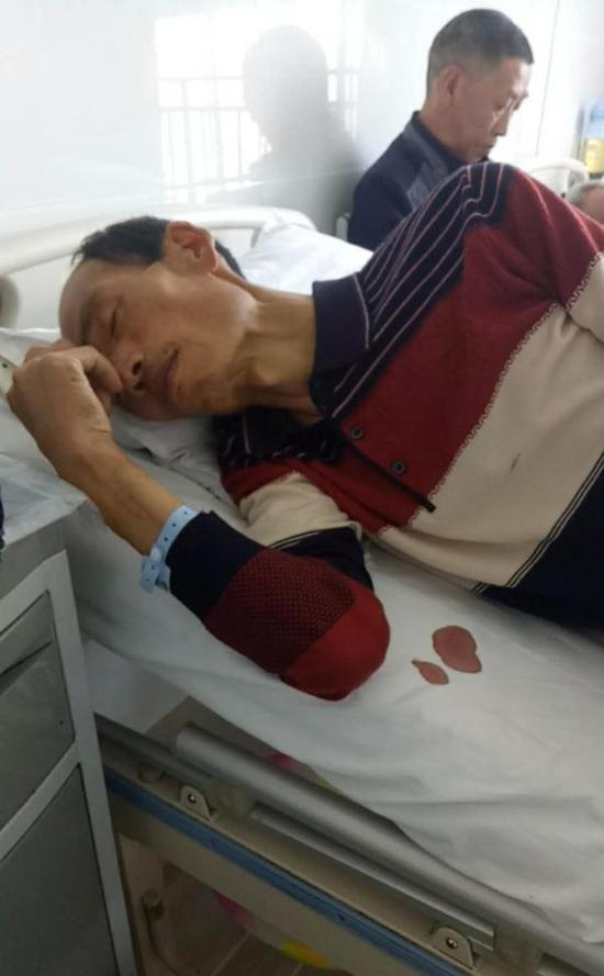 任云凯住院期间，只有80多斤。