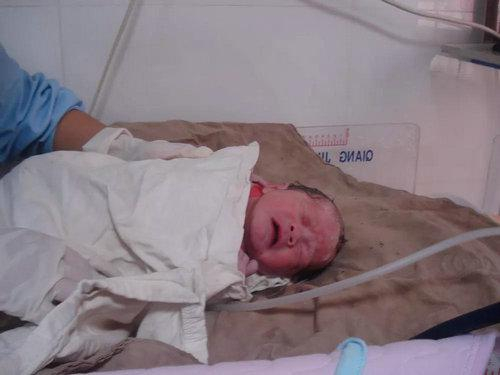 ▷涪蓉降生时的模样