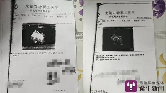 [案卷中收录的两份B超单，显示两种不同结果]