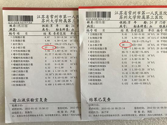 血常规检查报告