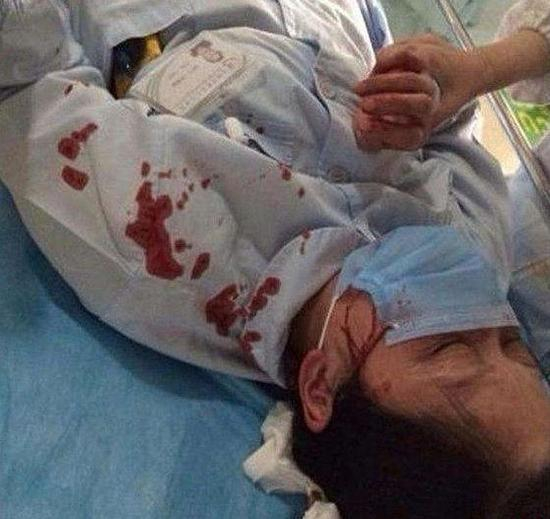 ▲女教师暴力伤医事件，曾引发轩然大波。