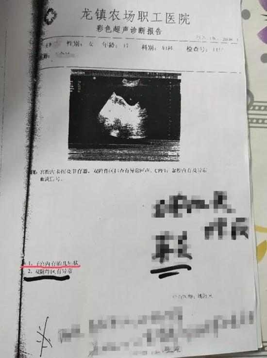 案卷中收录的其中一份B超单。（手写部分为律师阅卷时批注）受访者供图