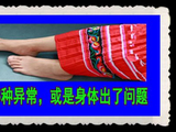 [转载]大病来袭，脚会说话！脚上若是出现这5种异常，或是身体出了问题【转自森焱】